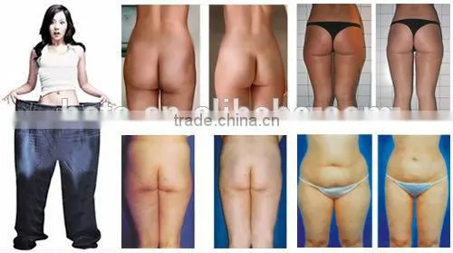 Guangzhou HETA New technology lipo laser cryolipolysis Beauty machine