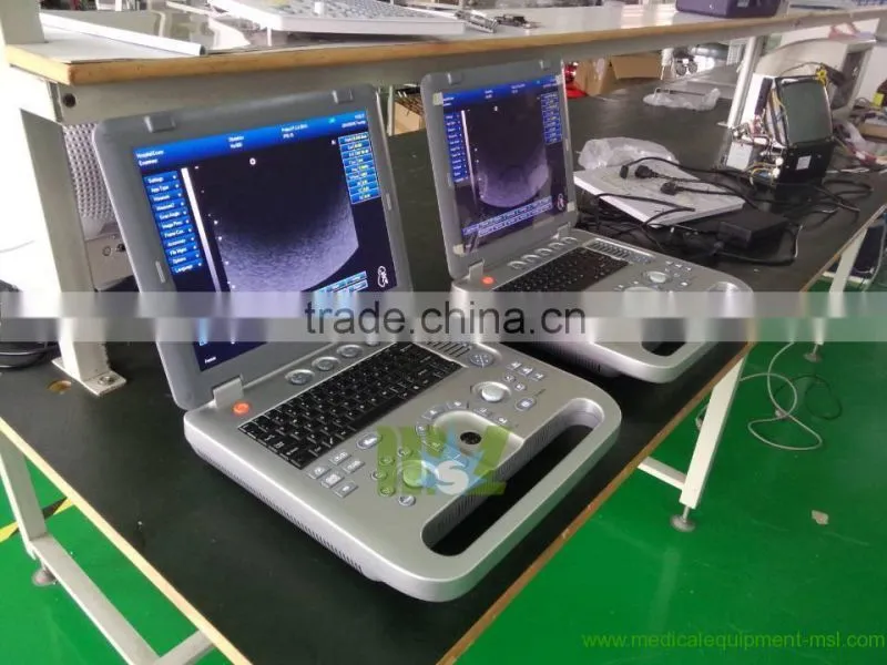 ultrasound machine ,ultrasound machine price,ultrasound scanner