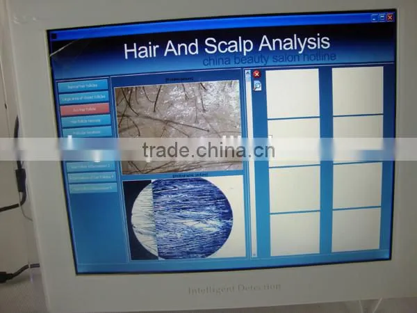 Degital Magic Mirror Hair Analysis Machine