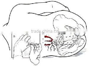 medical devices/spinal needle/qunicke chiba type and pencil point type spinal needle