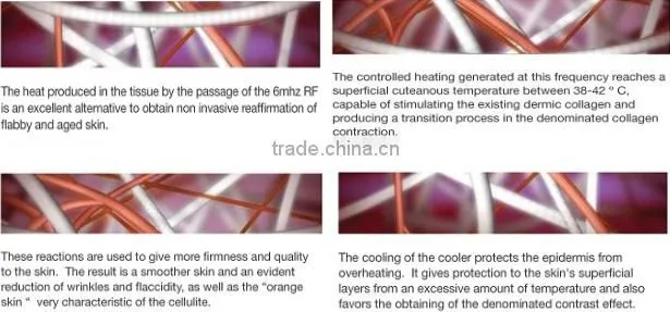 High Quality professional personal body care,6 in 1 fast cavitation&RF&Cavitation RF body slimming machine for sale