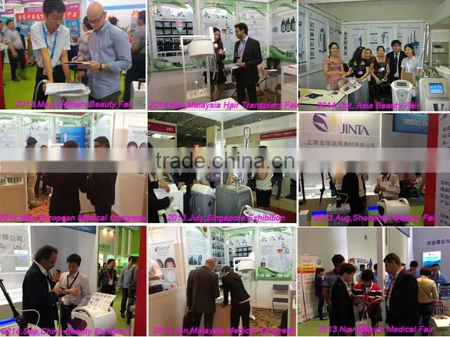 hot sale Factory direct SC-2 laser tube co2/acne removal laser tube co2/co2 vaginal rejuvenation