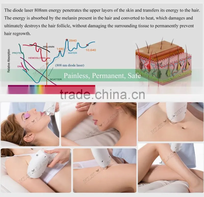 Semiconductor 808nm Diode Laser Hair Removal Machine