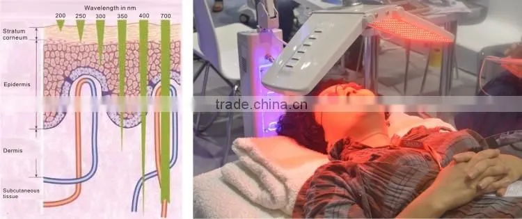 Professional suslaser PDT red led light therapy machine