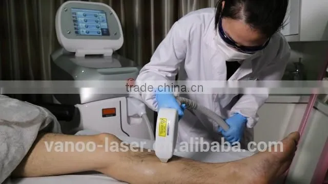 diode laser 808nm hair removal machine price Shanghai Vanoo Laser salon use