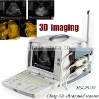 3D Color Doppler Ultrasound Machine with touch screen with competitive price MSLCU22-N