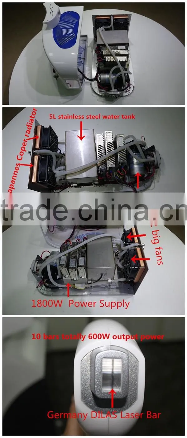 European 808nm diode laser! High Energy Dilas Laser Hair Removal