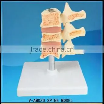 V-AM026 Spine Model