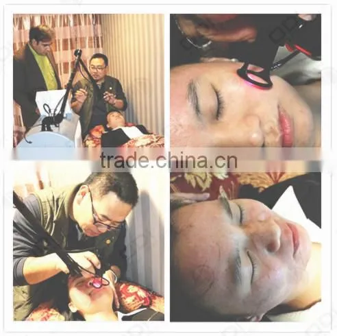 C600 beauty machine pigment removal fractional laser co2