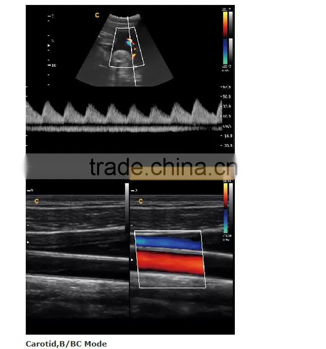2016 new Portable Color Doppler(Optional 4D) for cardiac use