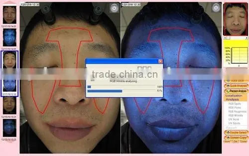 WT-01-S Magic Mirror skin analyzing machine