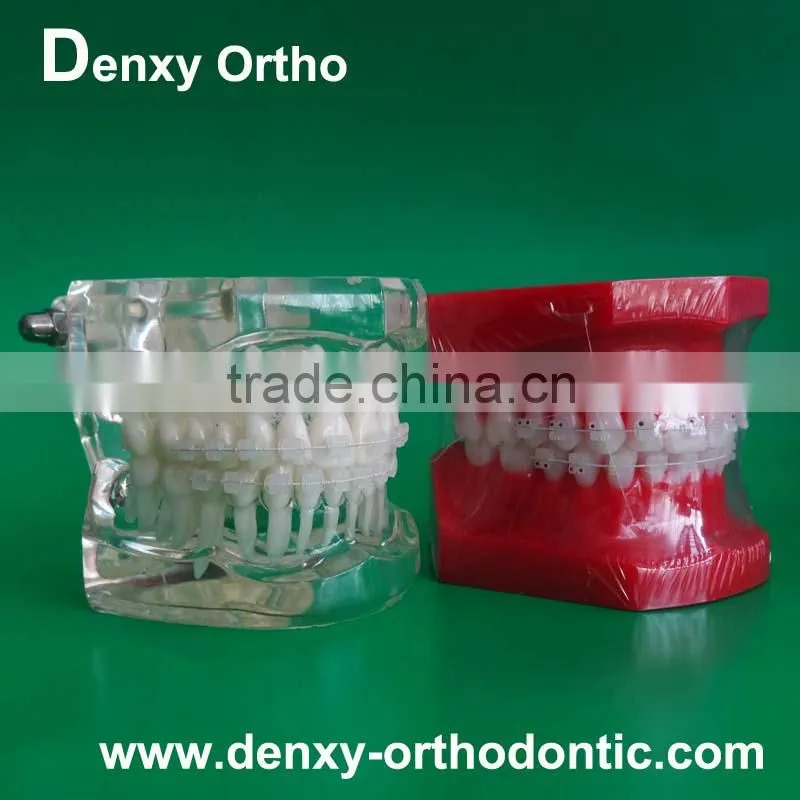 differnt types OEM dental orthodontic study model