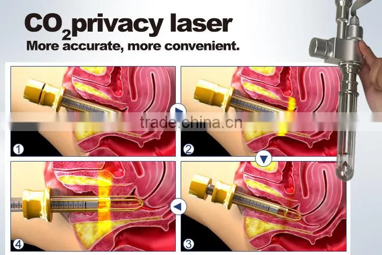 MED-870+ Laser Vertical co2 fractional laser beauty machine