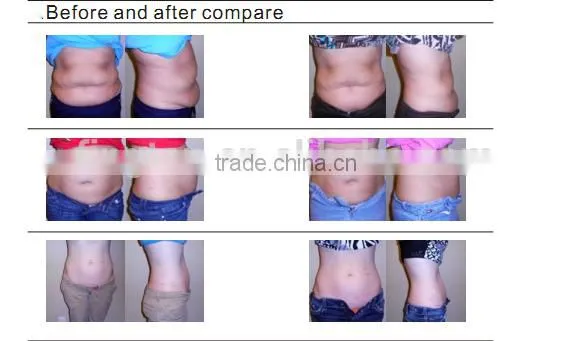 Beauty Salon Equipment High Quality ultrasonic cavitation machine price Beauty Device