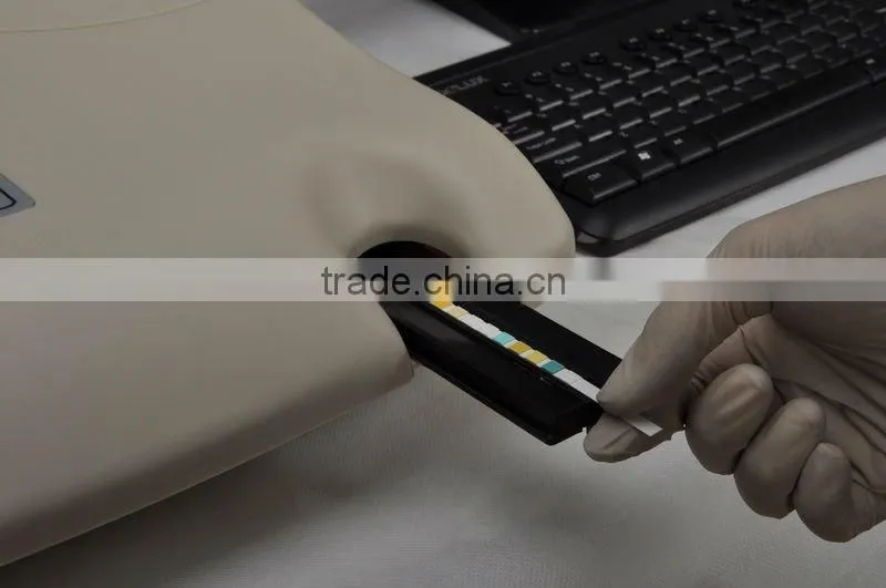 4 Test Items Urinalysis Analyzer