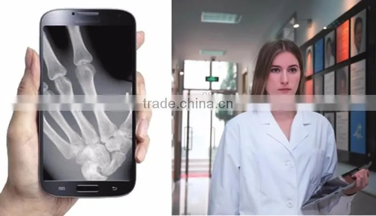 For All Kinds of X-ray Machine Flat Panel digital x-ray system