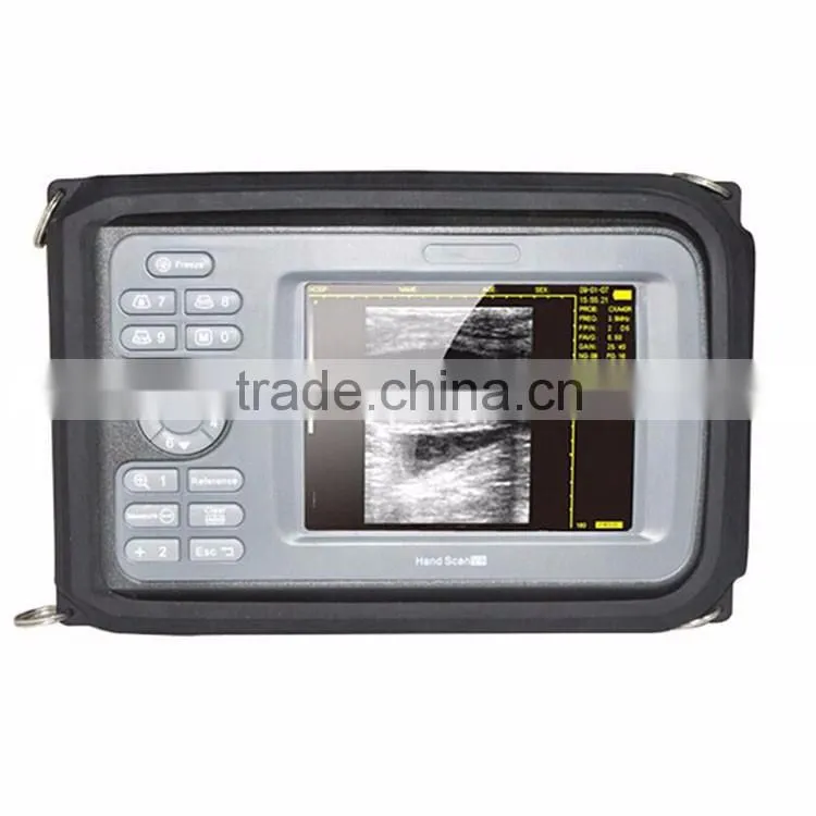 Handheld Touch Ultrasonic & Ultrasound Scanner mini Ultrasound Machine for sale