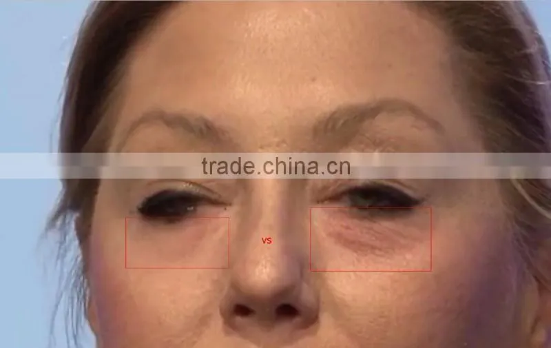 2016 New Arrival Instantly Ageless Eye Cream Anti Wrinkle Cream