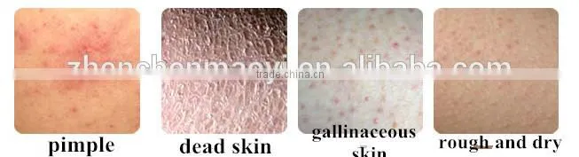 The best Yingxue exfoliating scrub cream