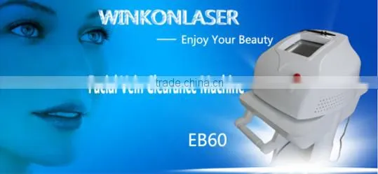 acne spider vein removal machine / high power spider vein removal machine / vascular vein spider vein removal rf