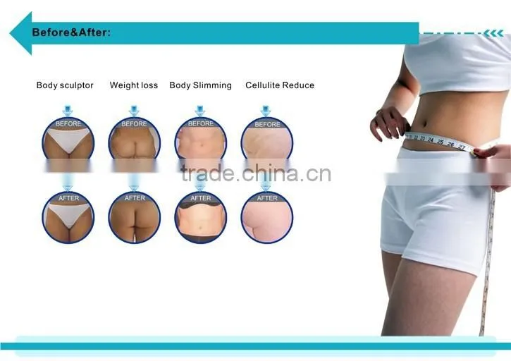 Portable vacuum cavitation RF system fat removal wrinkle removal body shaping beauty machine-V100 promotion price on sale!!!
