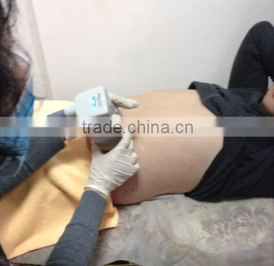 High quality hifu machine coming/ Hifu machine for slimming and skin care