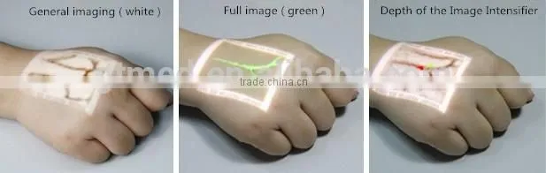 Infrared finds veins- Vertical machines