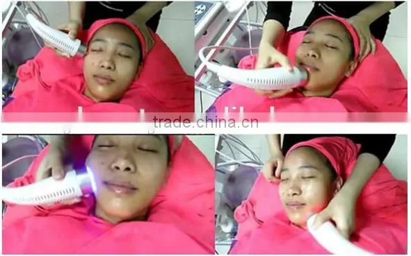 tri-polar bipolar rf facial wrinkle removal indian distributor want