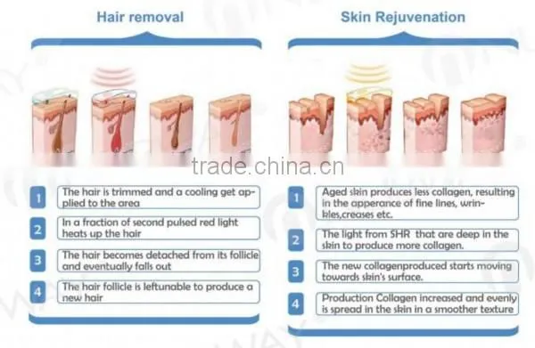 home and spa use depilator ipl shr hair removal machines