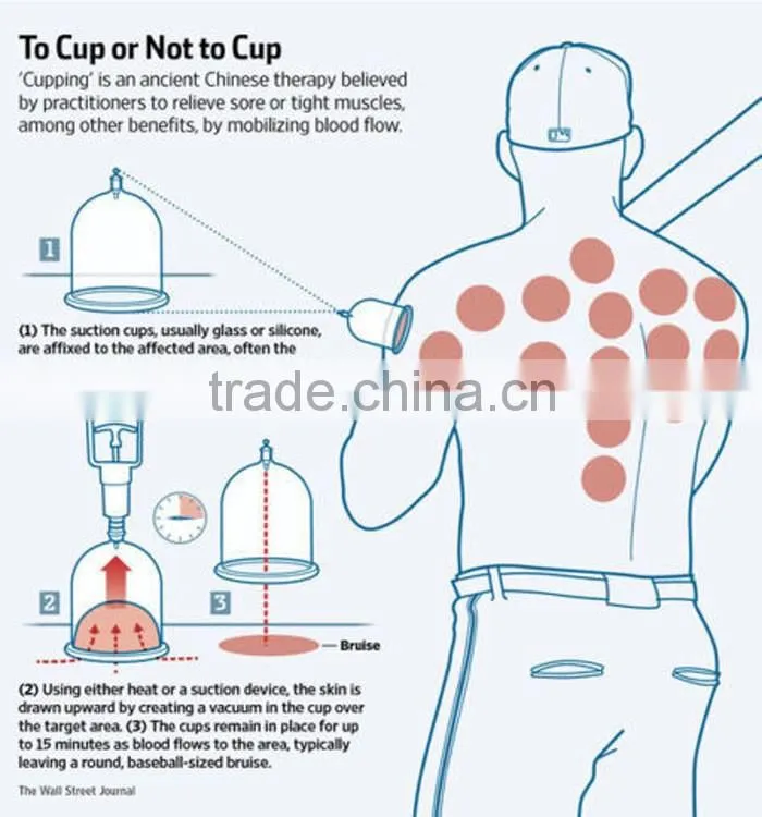 Chinese medical vacuum cupping set massager