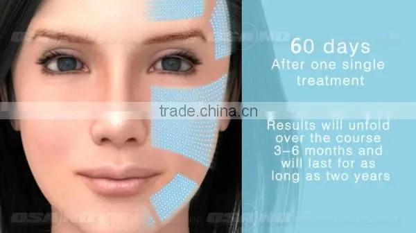 Low Price Hifu Skin Firming Ultrasound Facial Machines Hifu Machine