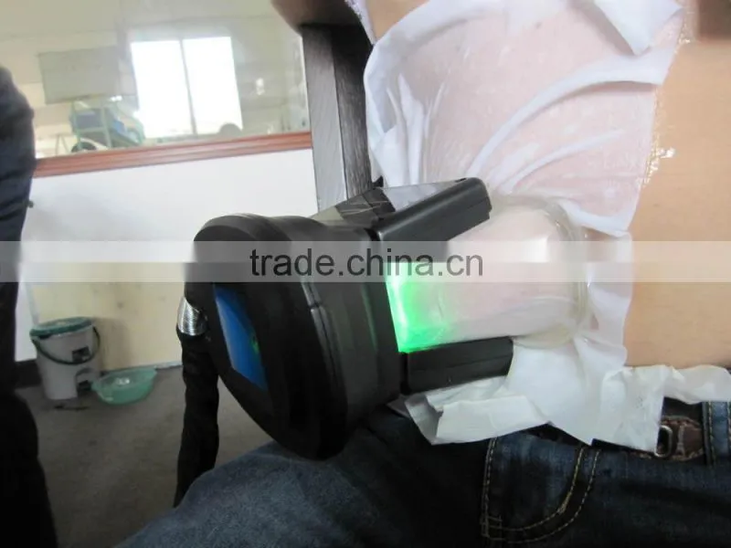Fast body slimming freeze belly fat away / cryolipolysis device
