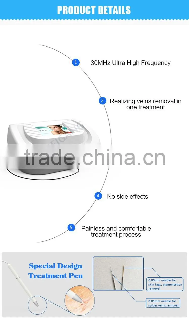 CE approved high frequency 30 MHz RBS laser spider vein removal machine for sale