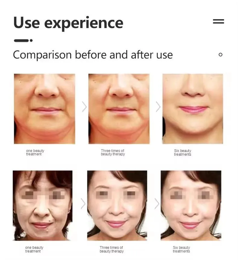 Home Use Cryo Vmax Facial Lifting for Beauty Salon