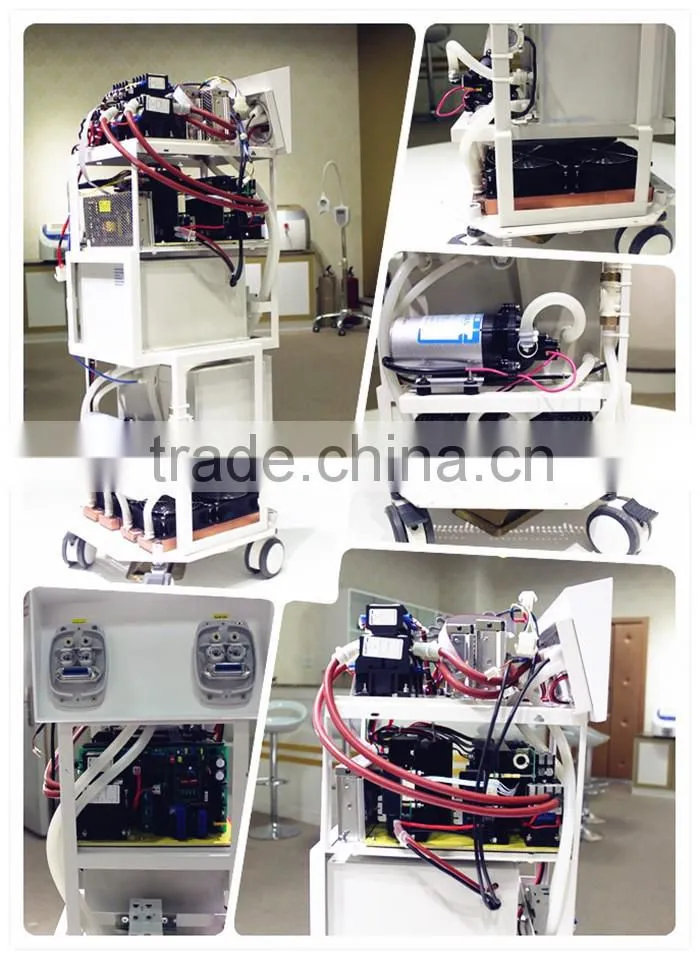 3000w strong power super fast hair removal system ipl shr lazer