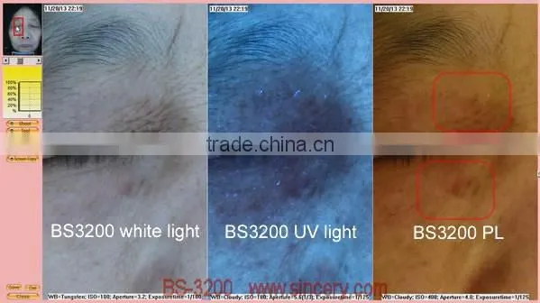 RGB/PL/UV tri-spectrum facial skin analyzer portable