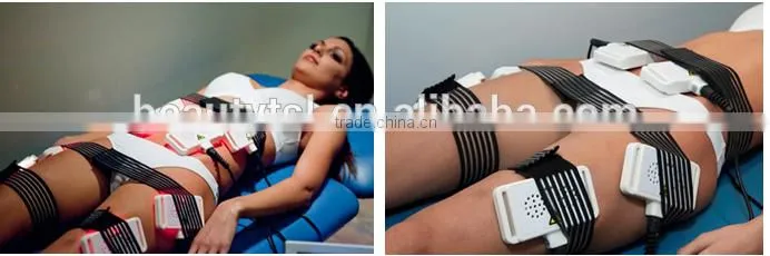 Radiofrequencia rf / portable lipo laser cavitation rf radio frequency device / bipoalr rf radio frequency