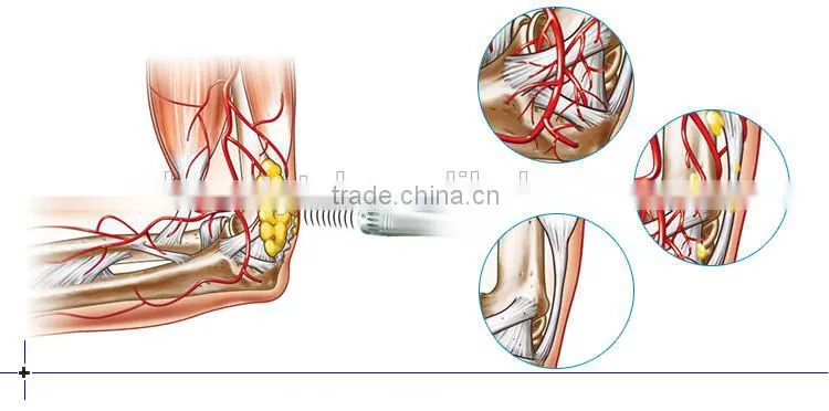 Shock Wave Therapy Physical Device for weight loss and cellulite
