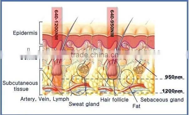 2014Distributors agents required permanent hair removal shr(CE SGS ISO TUV SFDA)