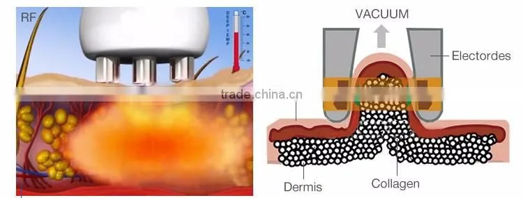 multifunctional 40khz cavitation panda box RF slimming machine