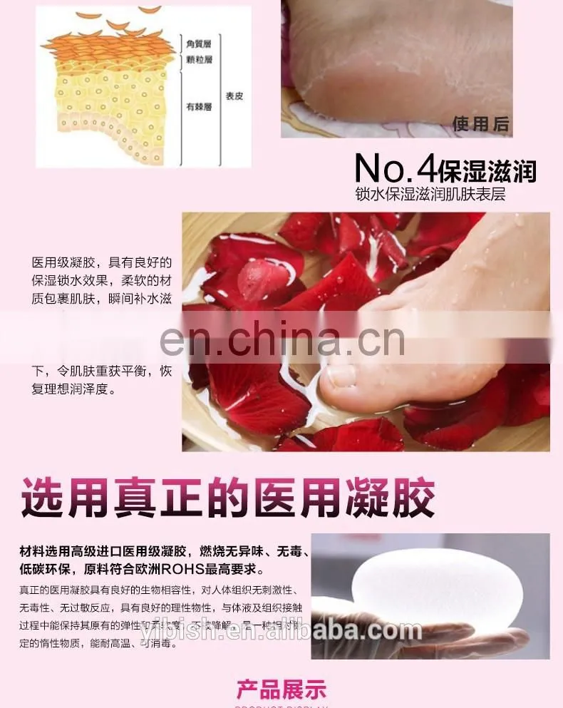 Ultra Comfortable Plantar Fasciitis Silicone Gel Heel Protective Support Sleeve - protecting cracked/dry heels #HG-011
