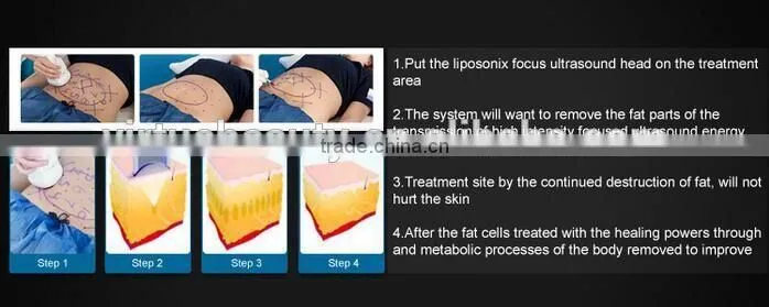 High quality professional body sculpting equipment hifu for body slimming
