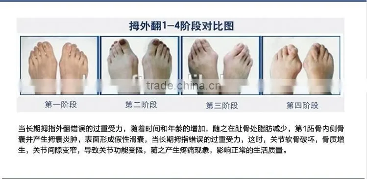 Silicone Gel Toe Separators Straightener Bunion Protector Corrector for Improving Foot Strength and Balance