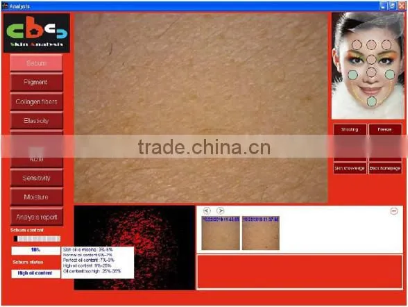professional made in Taiwan skin magnifier portable skin analysis equipment