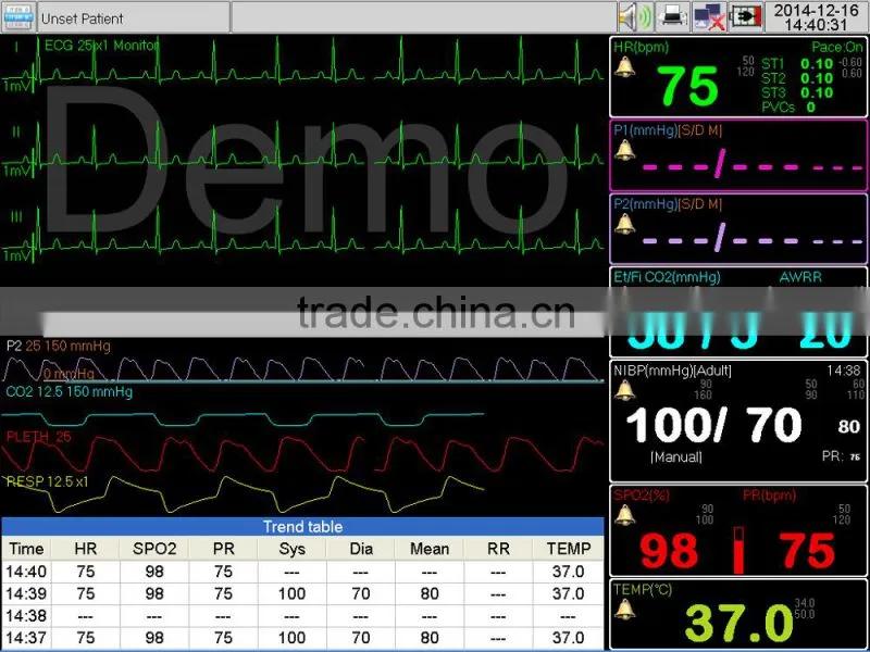 Patient vital signs monitor in recovery