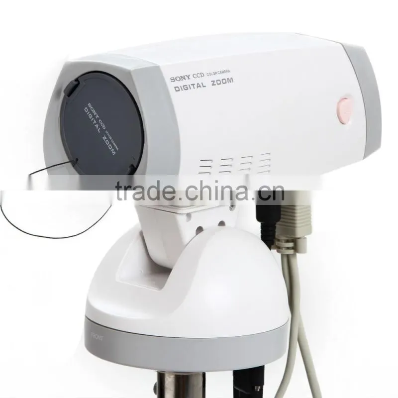 FY-9100A Excellent Portable Type Digital Electronic Colposcope
