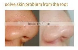 2014 new Skin Beauty Devices