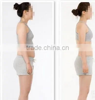 RF beauty salon equipment / Cavitation machine / Slimming Machine