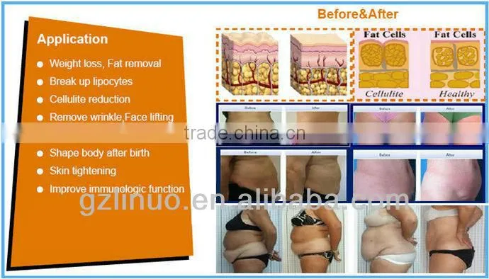 vertical Ultrasonic Slimming Cavitation Machine