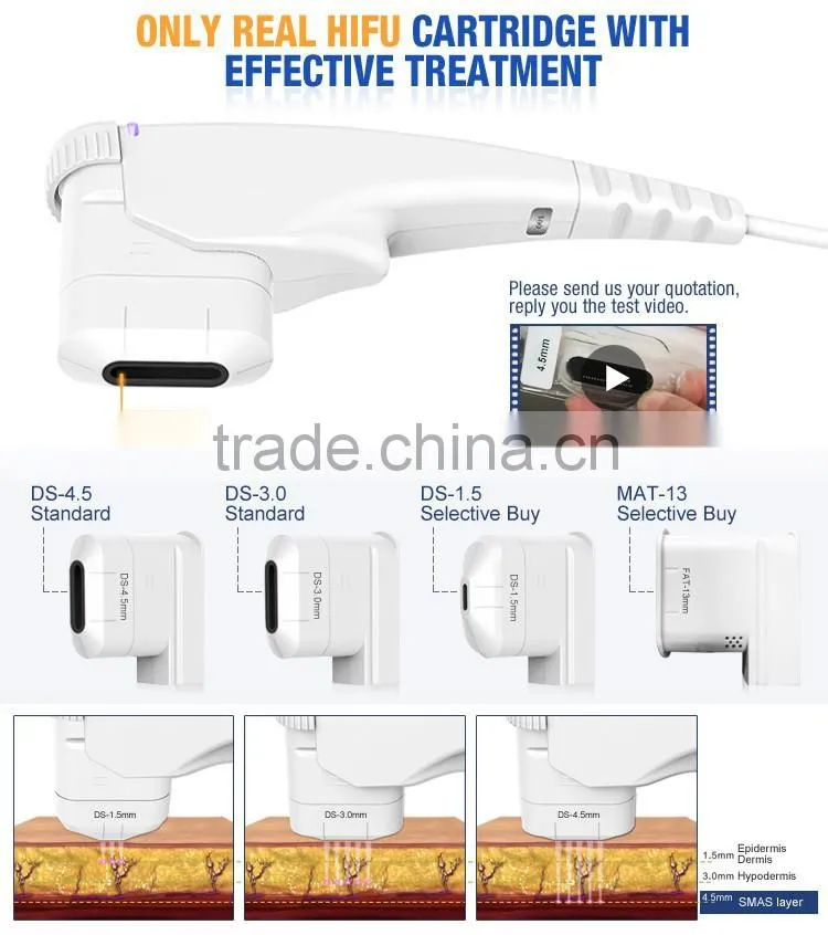 High Intensity Focused Ultrasound Hifu/ Hifu Anti-wrinkle With Amazing Effect